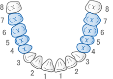 保険適用の歯