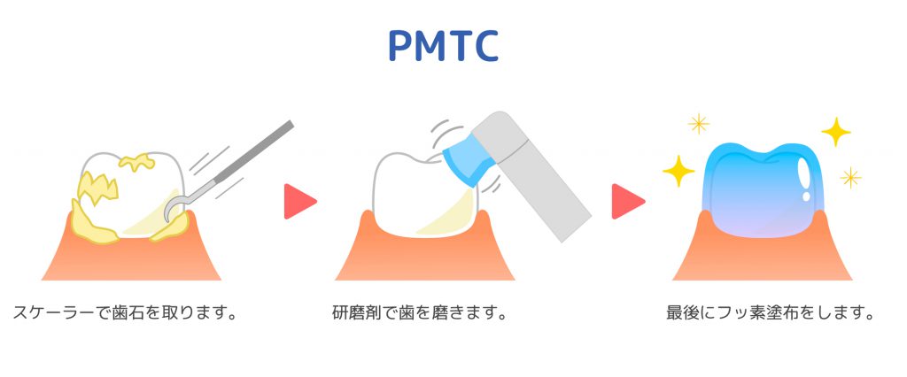 PMTCのながれ